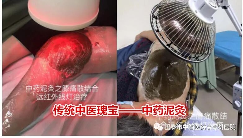 经颅磁治疗怎么样我院康复医学科引进康复“神器”——经颅磁刺激治疗仪_https://www.jmylbn.com_新闻资讯_第9张