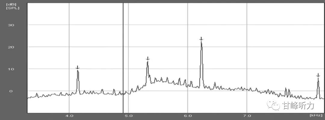 耳声发射图怎么看一分钟听力知识课堂丨耳声发射_https://www.jmylbn.com_新闻资讯_第3张