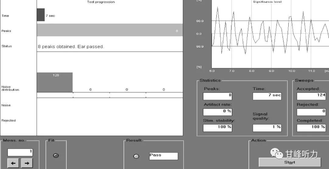 耳声发射图怎么看一分钟听力知识课堂丨耳声发射_https://www.jmylbn.com_新闻资讯_第8张