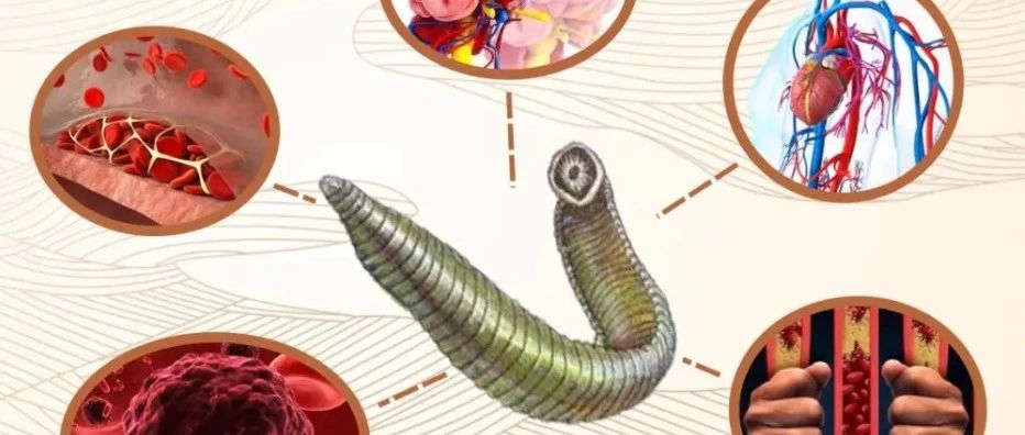 cover_image
