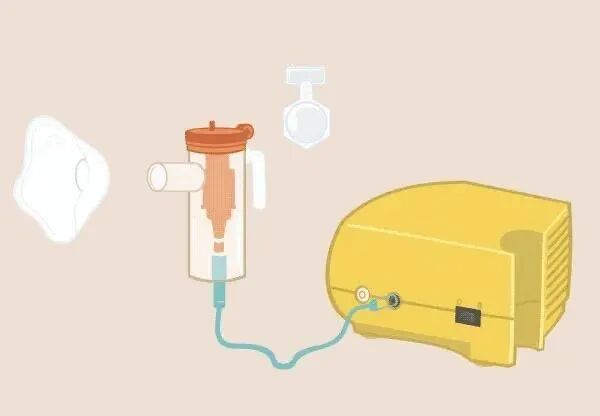 使用雾化器怎么呼吸雾化吸入，你做对了吗_https://www.jmylbn.com_新闻资讯_第2张