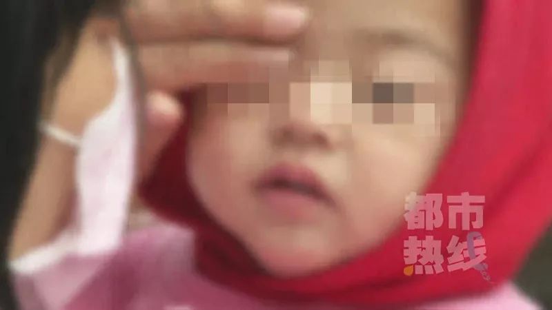 西安女子被自家狗撲咬重傷 皮膚撕脫、多處骨折 診斷為狂犬病Ⅲ級暴露！事發當時...... 寵物 第16張