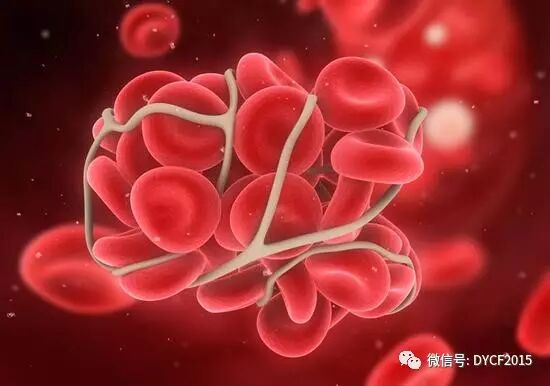 理疗仪怎么使用方法【理疗百科】手雷电极使用方法_https://www.jmylbn.com_新闻资讯_第4张