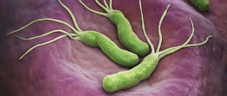 幽门螺杆菌被列入明确致癌物后是不是创新药差异化的机会？