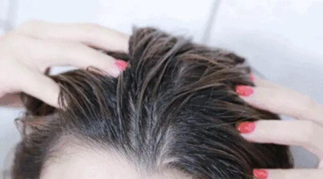 经常抠头皮屑有什么危害？