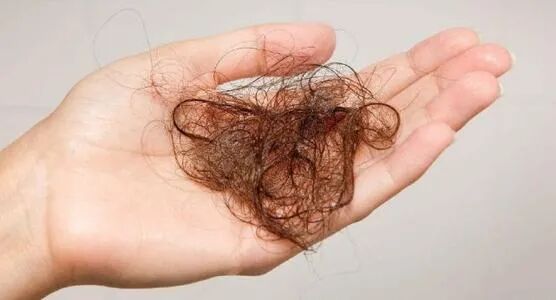 营养不良发质差的头发有哪些表现