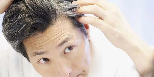 什么原因导致白发？怎么解决？