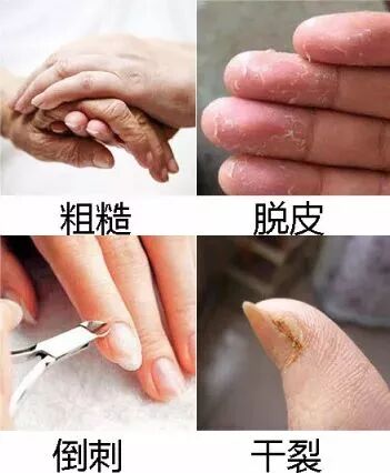 經常洗碗雙手越來越粗糙 塗點這個 嫩滑得令人愛不釋手 帶你去看好風光 微文庫