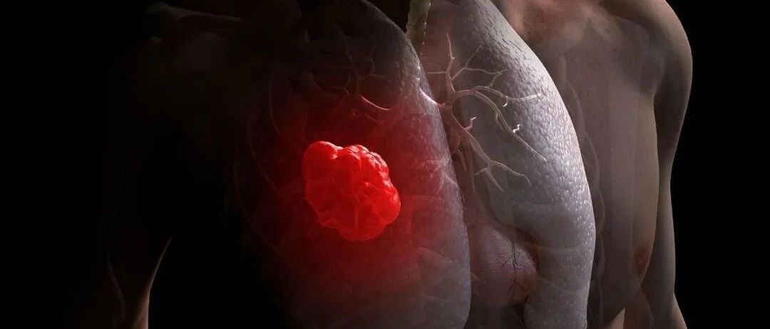 科研新发现|Nature子刊：从不吸烟的人也会得肺癌，他们的癌细胞从而来？