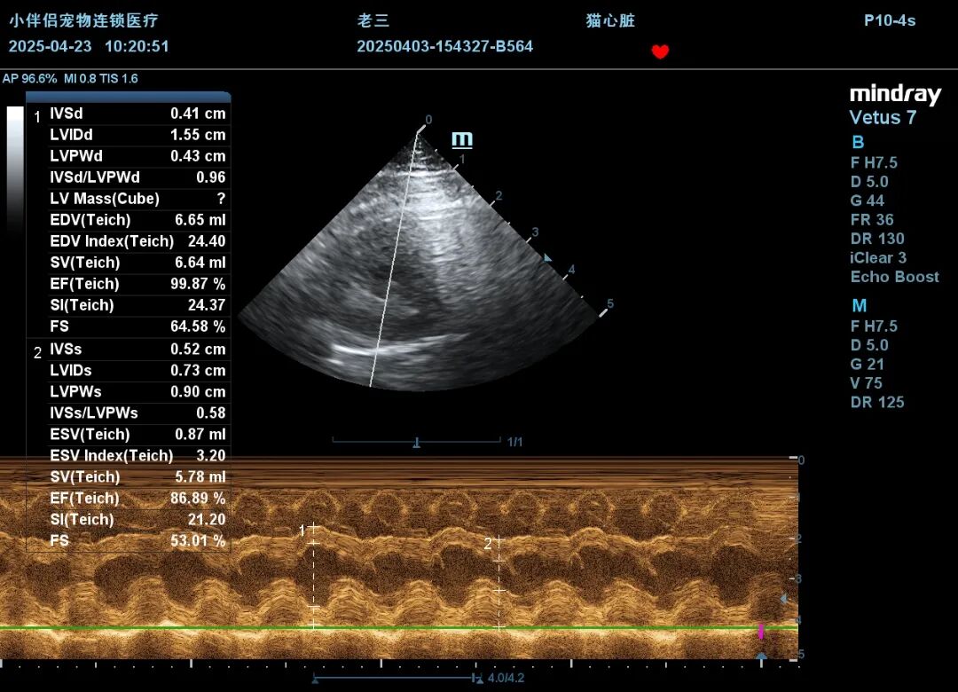 4.23心超M超.JPG