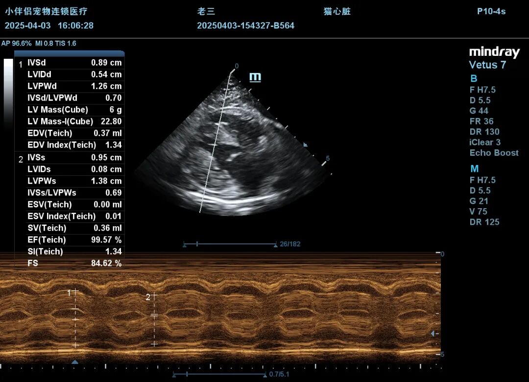 4.3心超M超.JPG