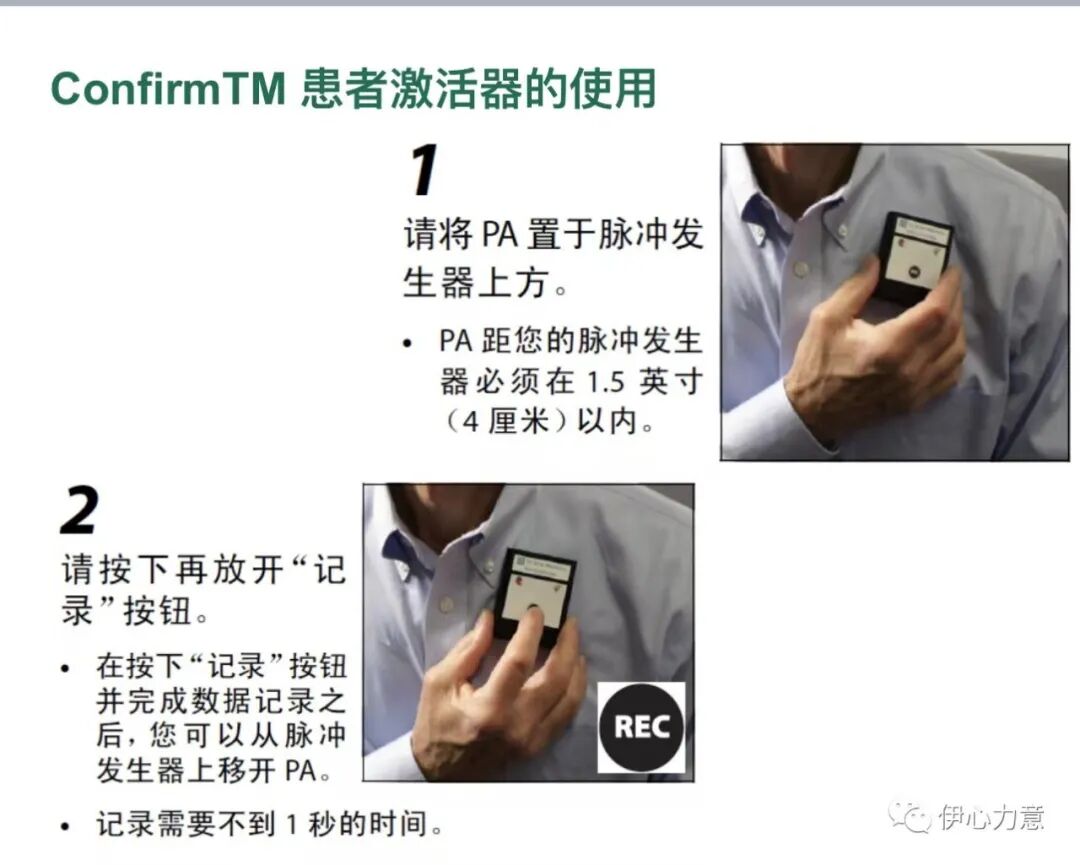 心电图怎么开手动发现猝死苗头的利器：植入式心电监测仪_https://www.jmylbn.com_新闻资讯_第4张