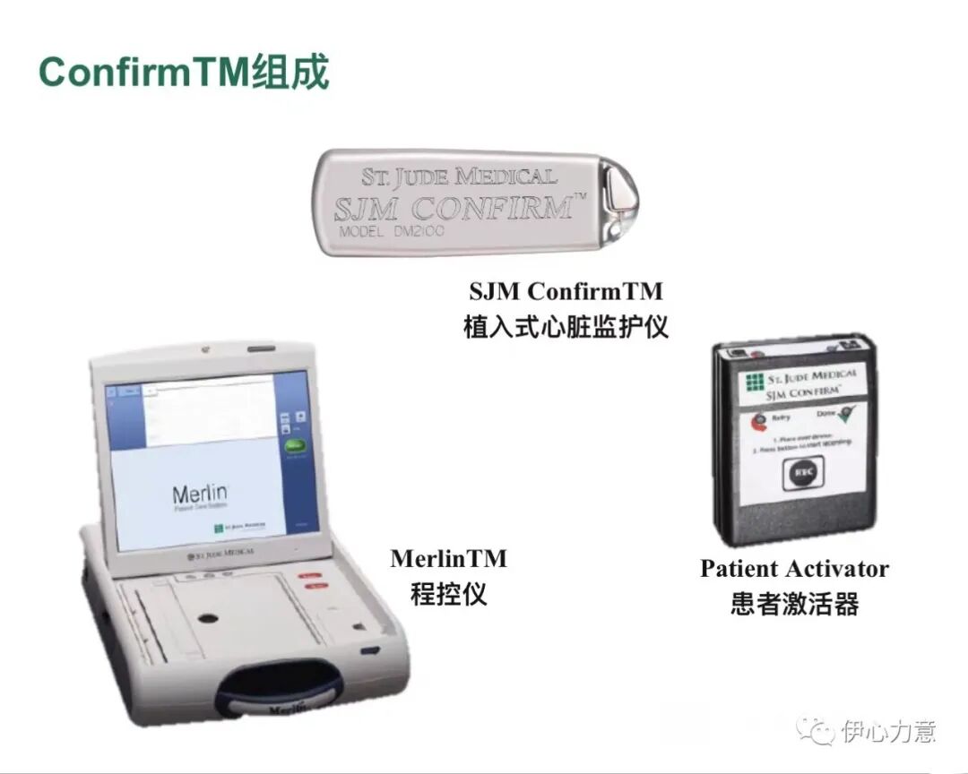 心电图怎么开手动发现猝死苗头的利器：植入式心电监测仪_https://www.jmylbn.com_新闻资讯_第2张