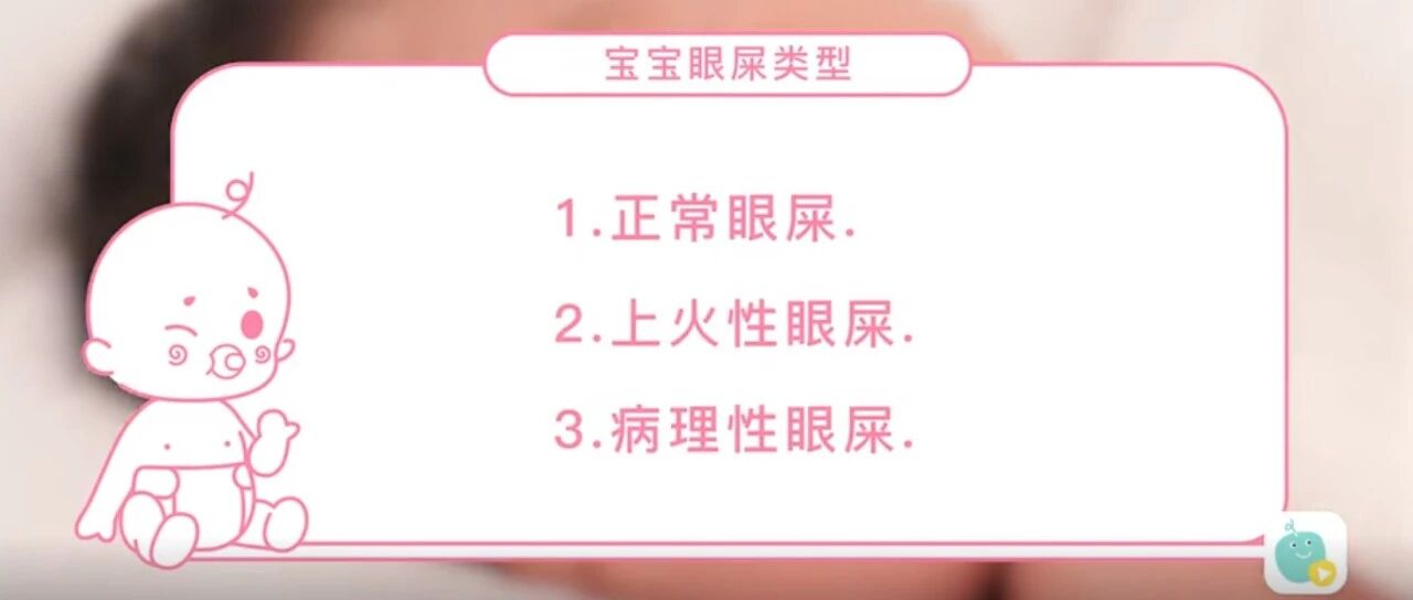 宝宝眼屎多，是上火了吗？