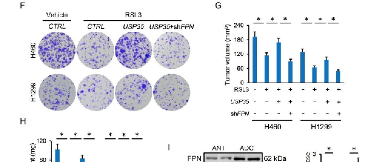 CTM期刊 | 在肺癌中去泛素化酶USP35通过靶向铁转运蛋白而调节铁死亡