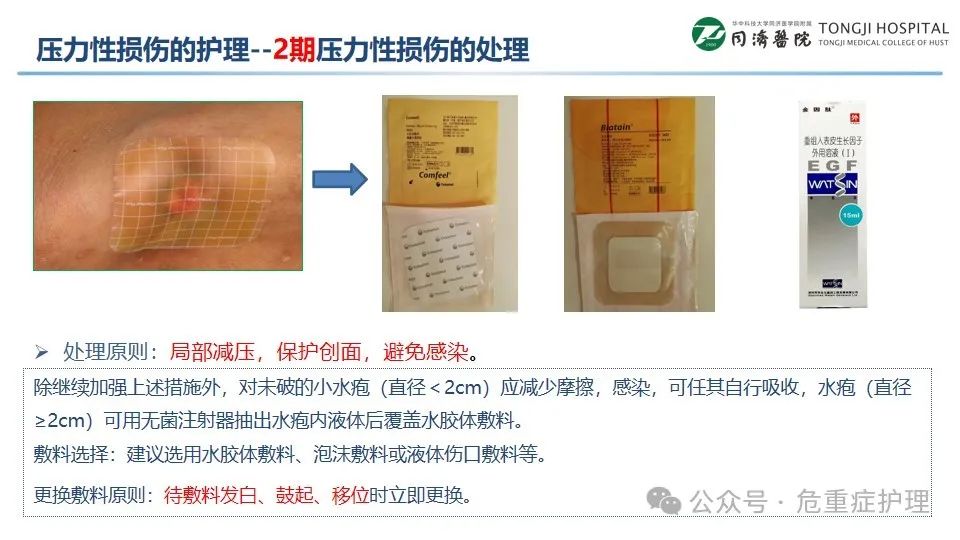 【ppt】压力性损伤的管理