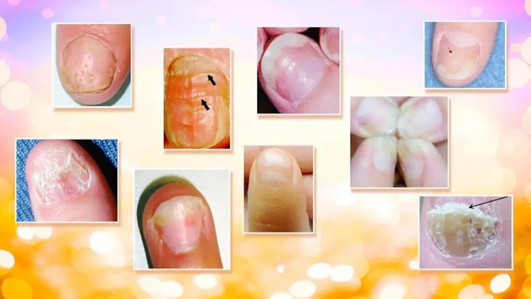 中午为什么好克睡怕冷、爱出汗、睡不好？中医专家私藏的小妙招，祛寒助阳，止汗安神，睡得香又甜~_https://www.jmylbn.com_新闻资讯_第17张