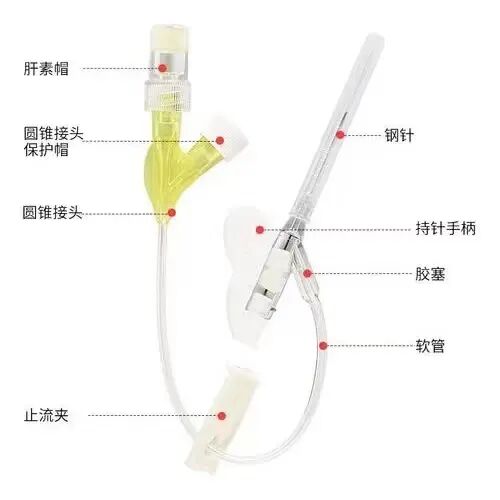 为什么要用留直针【Eyenurse.科普】眼科手术前为何要打静脉留置针？_https://www.jmylbn.com_新闻资讯_第3张