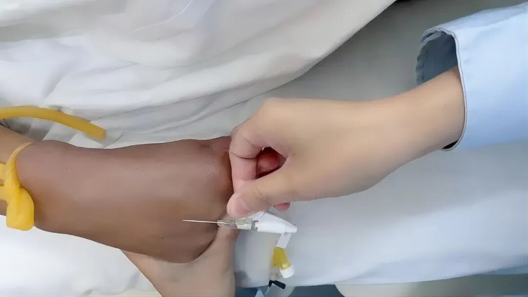 为什么要用留直针【Eyenurse.科普】眼科手术前为何要打静脉留置针？_https://www.jmylbn.com_新闻资讯_第2张