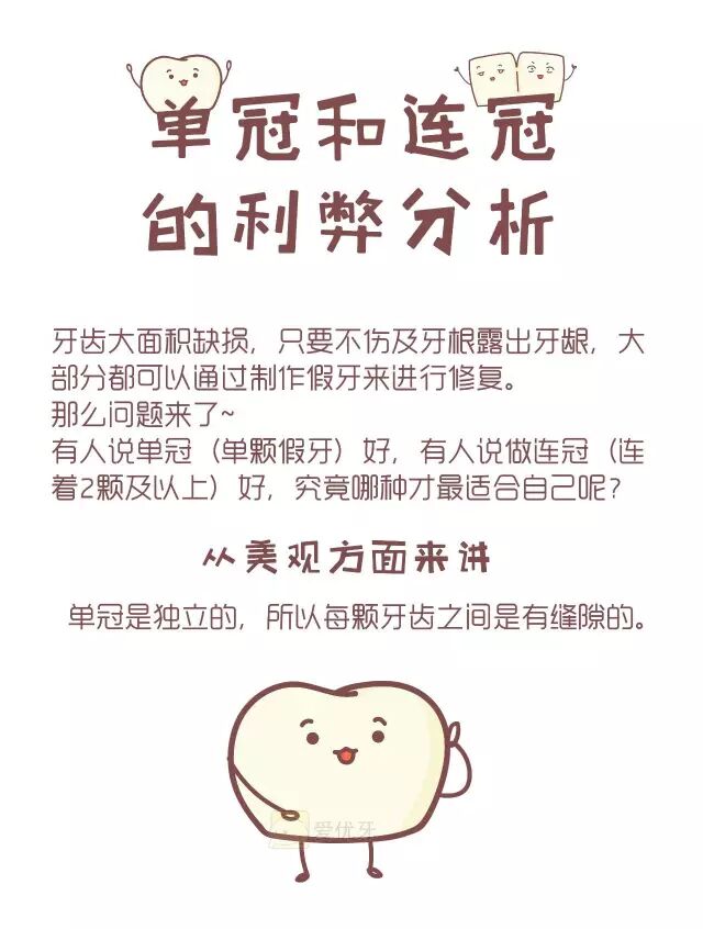 做假牙时单冠好还是连冠好？