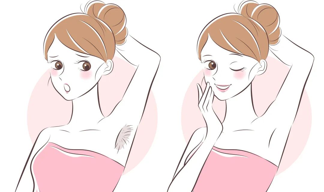 医用脱毛剂是什么科普 ｜ 夏天不做“猕猴桃”，这份脱毛攻略请收好_https://www.jmylbn.com_新闻资讯_第14张