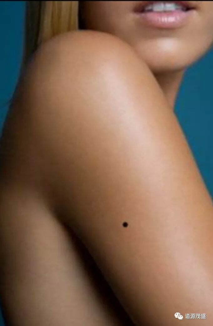 面相之解读手臂痣 道源茂盛 微信公众号文章阅读 Wemp