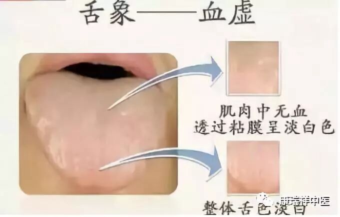 血虚都有哪些症状？怎么补才会好？-古方玉灵膏-贡轩园天然守真。