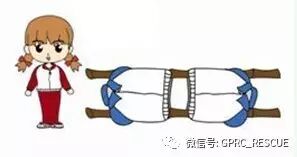 折叠担架怎么叠蓝天救援分享▎【安全知识】简易担架的制作_https://www.jmylbn.com_新闻资讯_第14张