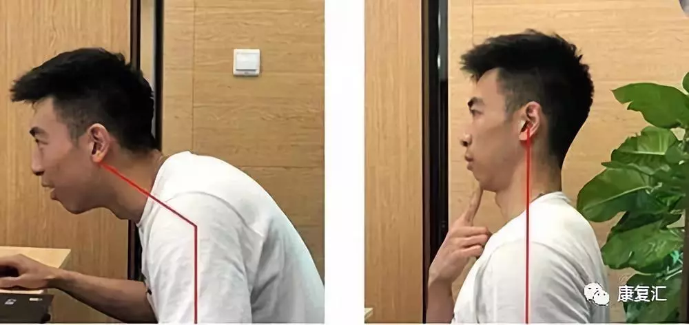 颈椎病还有很多奇怪症状,可惜很多人都不知道! 颈椎病还有很多奇怪症状,可惜很多人都不知道!