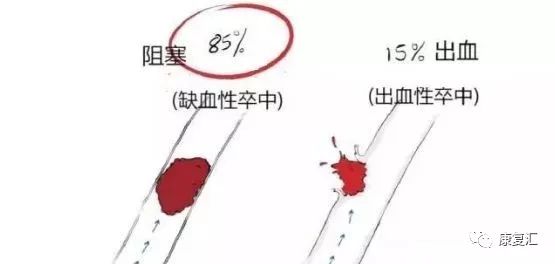 脑卒中康复训练漫画图解-微信头条网 脑卒中康复训练漫画图解