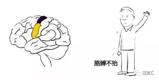 脑卒中康复训练漫画图解-微信头条网 脑卒中康复训练漫画图解
