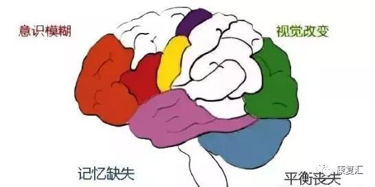 脑卒中康复训练漫画图解-微信头条网 脑卒中康复训练漫画图解