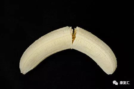 骨折术后的康复期至关重要