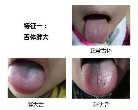 孩子感冒咳嗽，不一定非得打針吃藥，好父母應該這樣做！ 親子 第2張