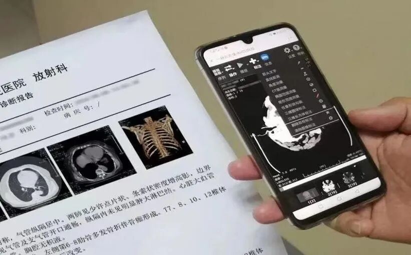 dr胶片怎么看手机查报告，CT  MRI  DR影像掌上看.......玉山中医院医学影像“云”平台上线！_https://www.jmylbn.com_新闻资讯_第10张