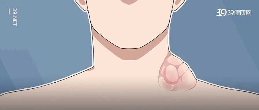 年年体检都正常，却查出癌症晚期！体检漏了这1步等于白做