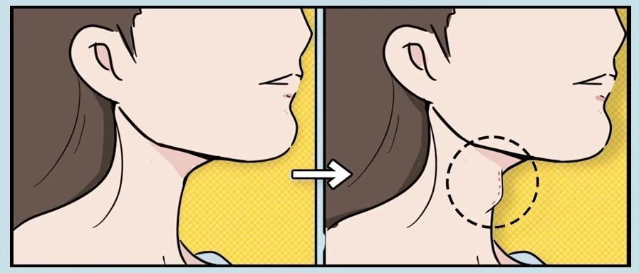 身上这些部位有凸起，可能是癌症前兆！