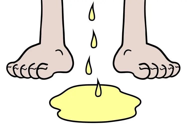 前列腺增生早期最为常见的症状就是夜尿增多,发展到后期还会出现尿液