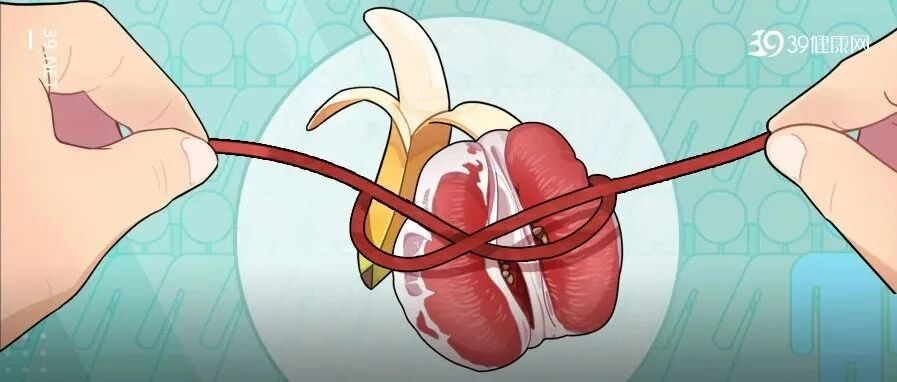 男性结扎和女性结扎，哪个伤害更大？结扎会降低性能力？早知道早受益