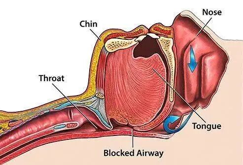 人为什么自动呼吸机越来越多的年轻人需要靠呼吸机才能入睡_https://www.jmylbn.com_新闻资讯_第3张