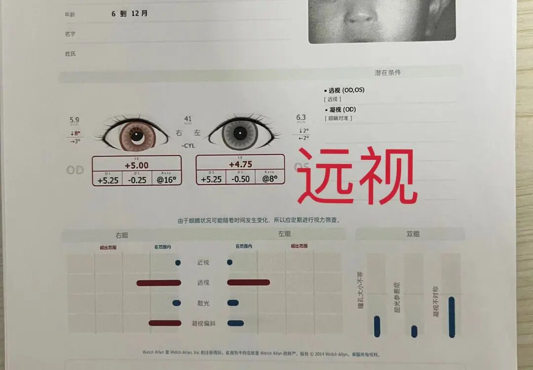伟伦视力是什么关爱儿童视力，定期开展视力筛查_https://www.jmylbn.com_新闻资讯_第8张