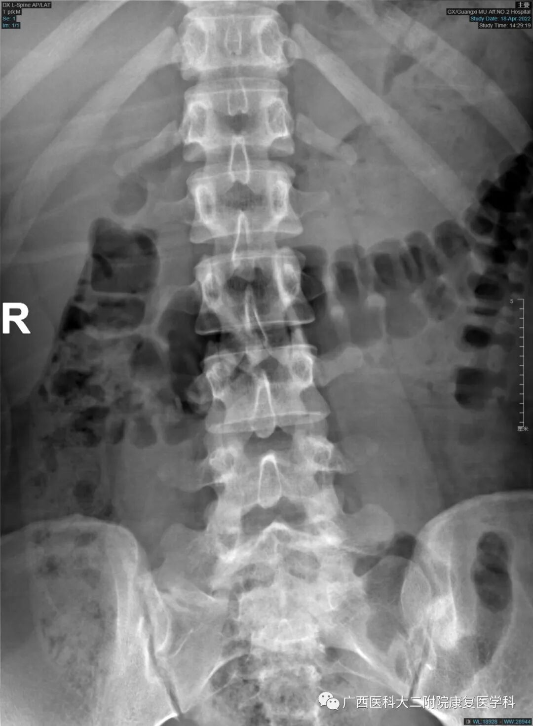 悬吊训练系统 怎么装S-E-T悬吊训练技术在下背痛中的应用_https://www.jmylbn.com_新闻资讯_第5张