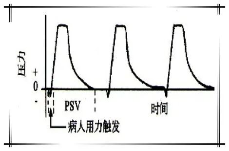 怎么备呼吸机ICU必备工具：呼吸机的使用你知多少_https://www.jmylbn.com_新闻资讯_第6张
