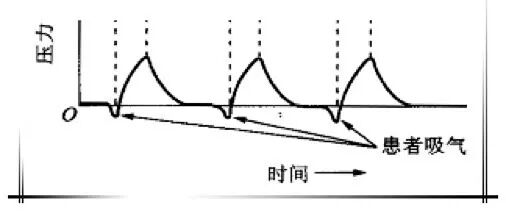 怎么备呼吸机ICU必备工具：呼吸机的使用你知多少_https://www.jmylbn.com_新闻资讯_第5张
