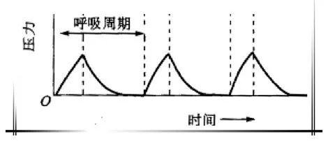 怎么备呼吸机ICU必备工具：呼吸机的使用你知多少_https://www.jmylbn.com_新闻资讯_第4张