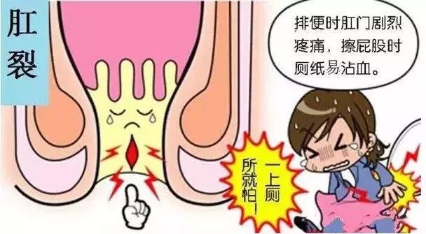肛门痛究竟是因为什么?