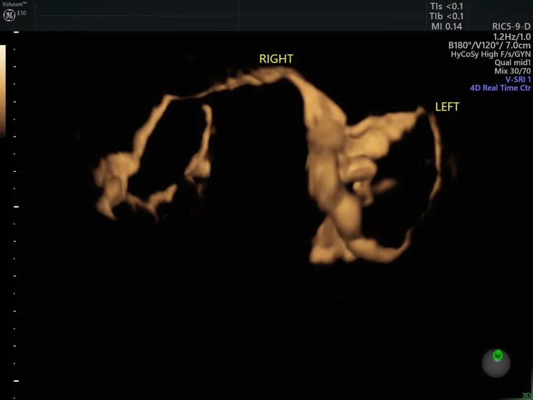 为什么妇科检查灯那么暗【秋来“孕”转】女性健康探路灯——泰州市中医院能做哪些妇科超声检查？_https://www.jmylbn.com_新闻资讯_第5张