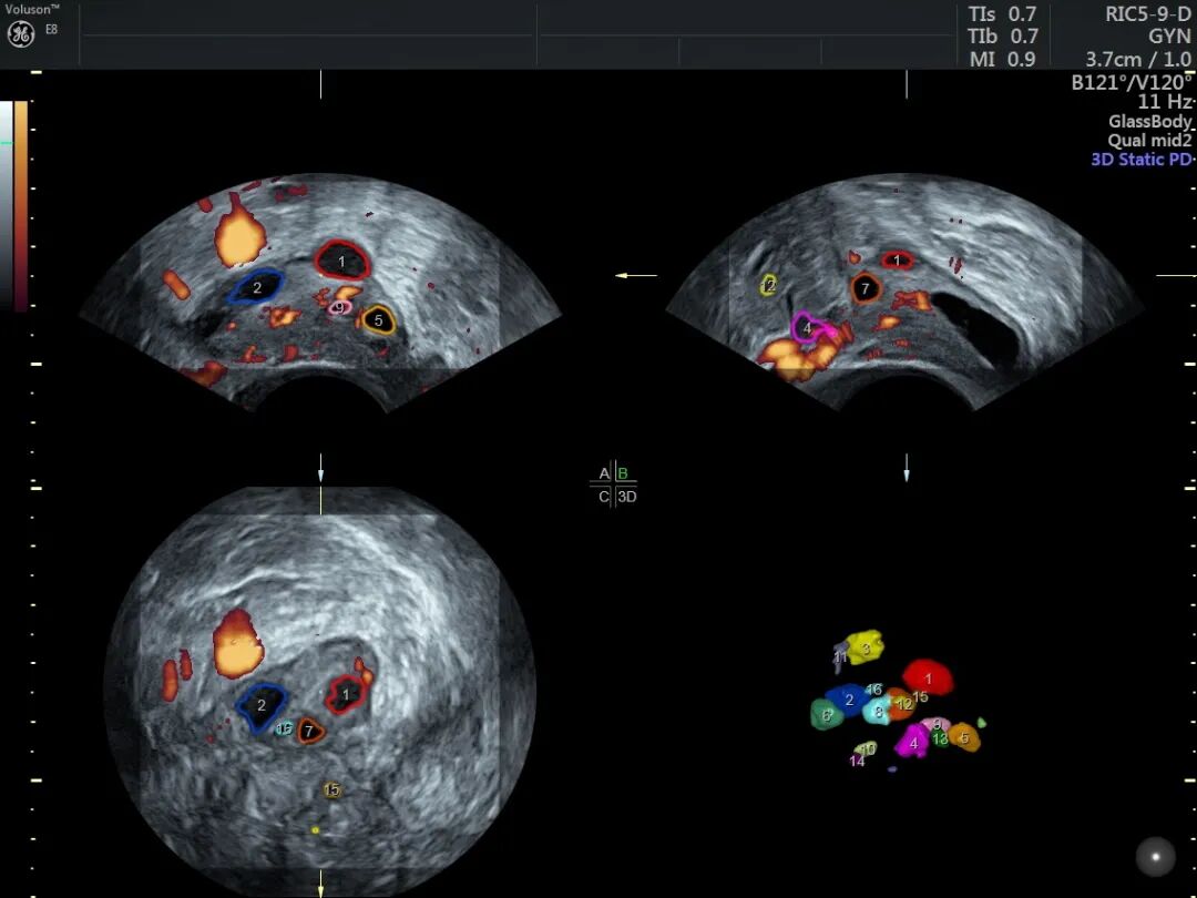 为什么妇科检查灯那么暗【秋来“孕”转】女性健康探路灯——泰州市中医院能做哪些妇科超声检查？_https://www.jmylbn.com_新闻资讯_第7张