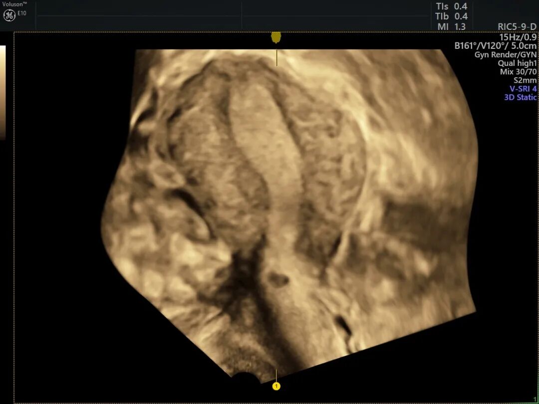 为什么妇科检查灯那么暗【秋来“孕”转】女性健康探路灯——泰州市中医院能做哪些妇科超声检查？_https://www.jmylbn.com_新闻资讯_第9张