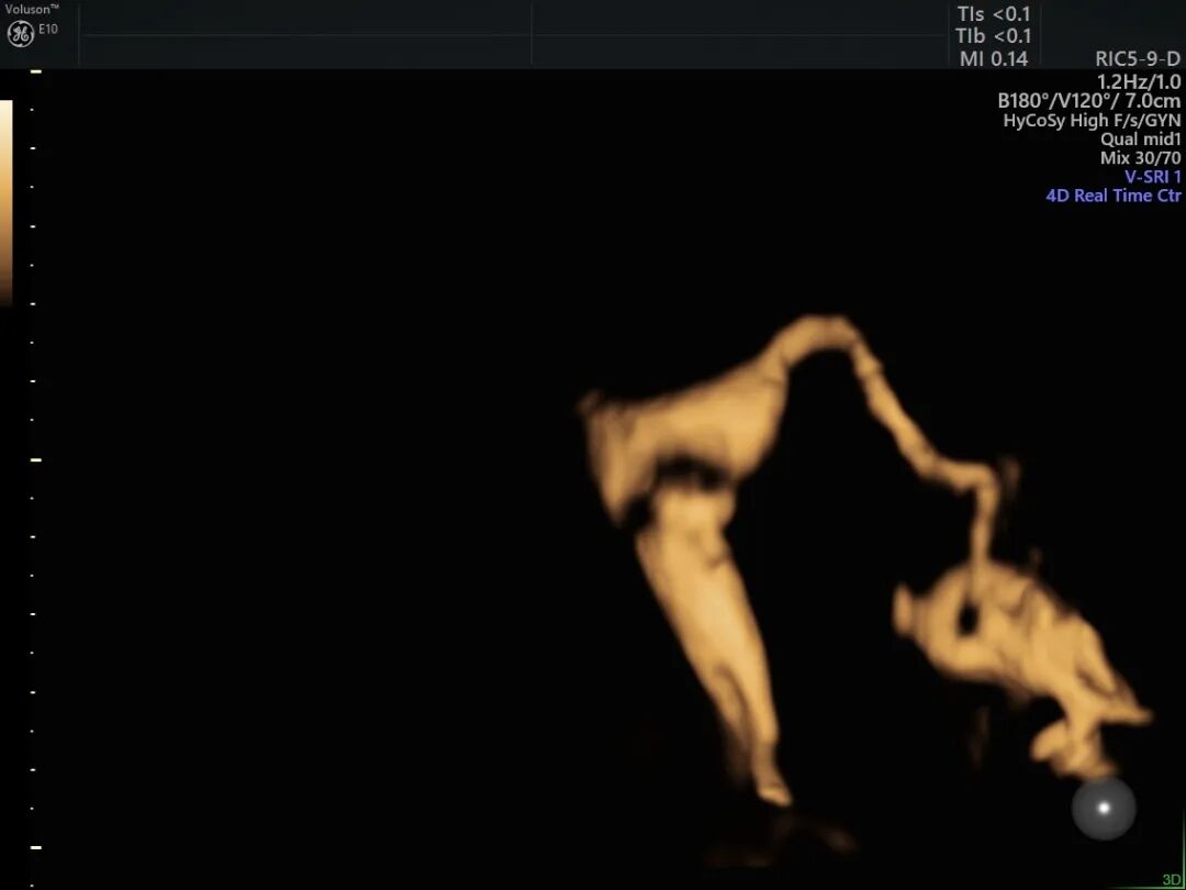 为什么妇科检查灯那么暗【秋来“孕”转】女性健康探路灯——泰州市中医院能做哪些妇科超声检查？_https://www.jmylbn.com_新闻资讯_第6张